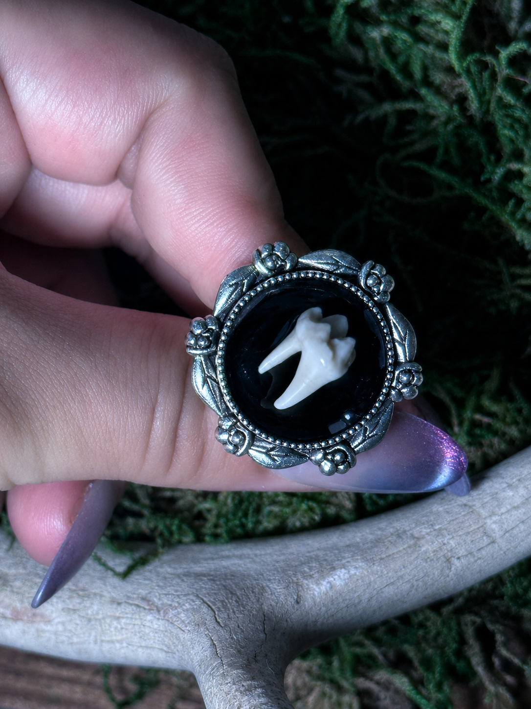 Tooth Rings